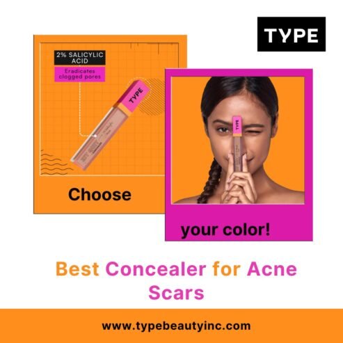 Buy Best Concealer for Acne Scars