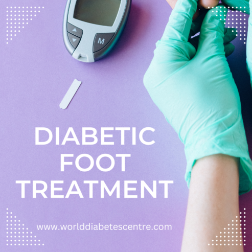 Comprehensive Diabetic Foot Treatment: Manage Symptoms and Prevent Complications