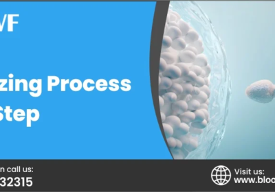 Egg-Freezing-Process-Step-by-Step