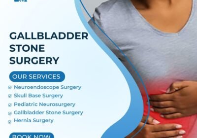 Gallbladder-Stone-Surgery
